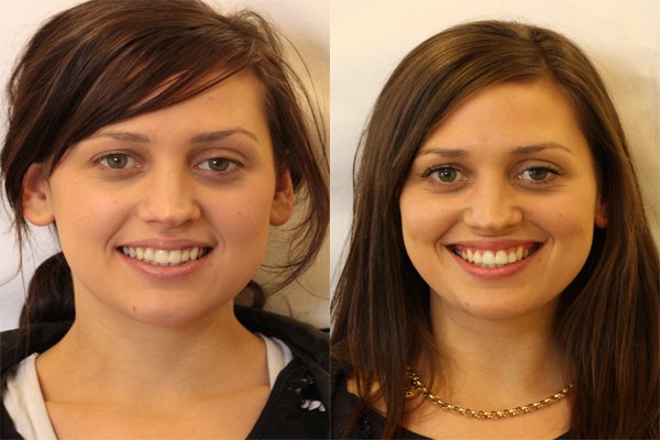 glenview dental treatment